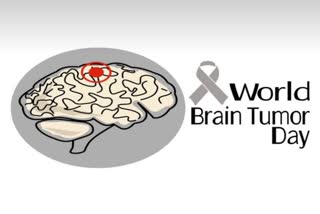 Etv BharatWORLD BRAIN TUMOR DAY 2023