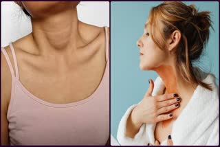 How To Get Rid Of Dark Neck