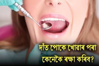 Is cavity bothering you? Do such measures to save teeth from decay