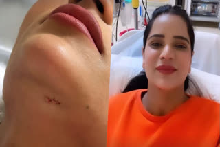 Archana Gautam gets hurt on KKK 13 set, shares video post surgery