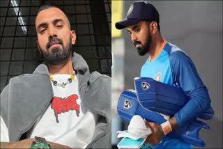 Etv BharatKL Rahul Health Update