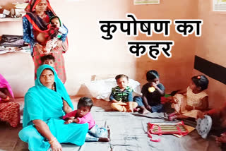 malnourished in chhatarpur