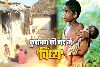 children malnourished in satna