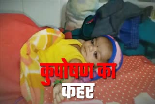 malnutrition-is-increasing-in-narsinghpur