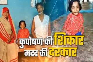 victim of malnutrition Pooja Sahu