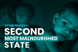 UP stands second most malnourished state