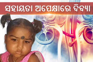 3years-girl-suffering-in-kidney-disease