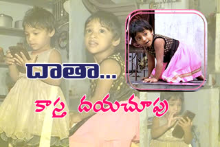 three years old baby from khammam district  is suffering from bone marrow problem and her parents are requesting for financial help