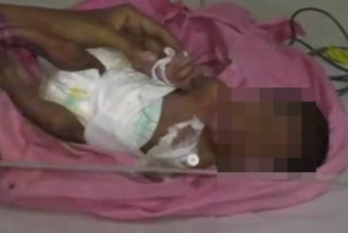 city-of-ulhasnagar-a-male-infant-was-found-alive-in-a-drain