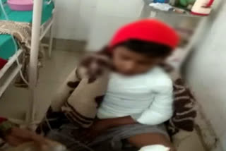 neighbors set fire to 10-year-old child in sirsa