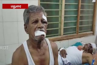 madurai-thirumangalam-ward-member-family-have-been-attacked-brutally