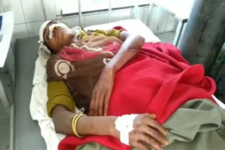dholpur news, woman attacked due to rivalry dholpur, woman attacked with an ax dholpur, धौलपुर समाचार, रंजिश के चलते महिला पर हमला धौलपुर, महिला पर कुल्हाड़ी से हमला धौलपुर