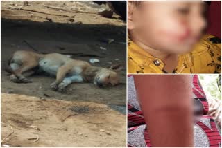 Street dog attacks on childrens in belgavi