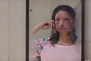 CHHAPAAK MAKERS SHOULD GIVE DUE CREDIT TO LAWYER DELHI COURT