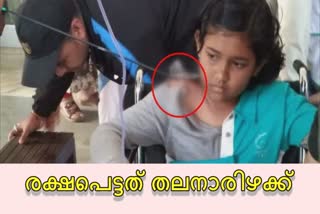 Assam archer injured  Young Archer injured  SAI Archer injured  Archer injured  Archer hit by an arrow  അസം ആർച്ചക്ക് പരിക്ക് വാർത്ത  കുട്ടി ആർച്ചർക്ക് പരിക്ക് വാർത്ത  സായി ആർച്ചർക്ക് പരിക്ക് വാർത്ത  ആർച്ചർക്ക് അമ്പേറ്റു വാർത്ത