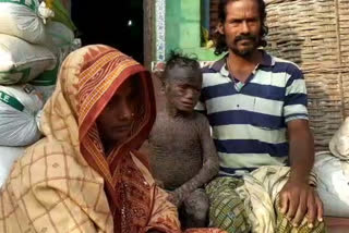 10 years old boy Down with an unknown disease in gunjam odisha