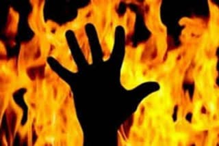 Mistress set a fire on his boyfriend in karnataka  പെണ്‍കുട്ടി കാമുകനെ തീകൊളുത്തി  ബംഗളൂരു  കര്‍ണാടക  കര്‍ണാടക ക്രൈം ന്യൂസ്  karnataka  crime latest news