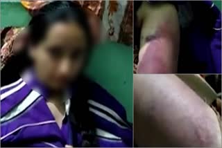 mandi domestic violence video मंडी में महिला से मारपीट का वीडियो