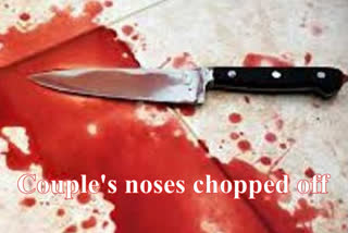 Couple's noses chopped off over an illicit affair in UP