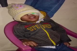 child-suffering-from-vascular-tumor-did-not-receive-treatment