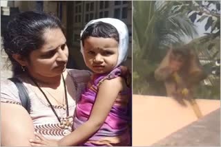 monkey attack on two years old girl in gadag