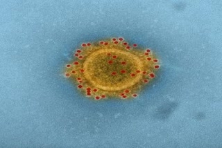 coronavirus