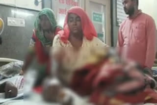 Bikaner News, बीकानेर न्यूज़, Attacked on Mother, तलवार से हमला