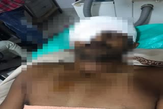 bear attacked on farmer in buldhana