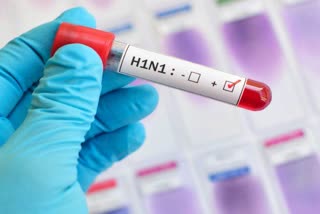 Two new cases of swine flu in IGMC