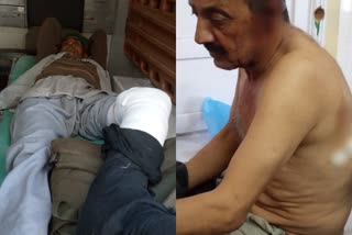 One brother fired on another in Kumarasain