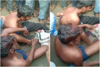 two youngsters were brutally beaten