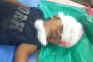 Small boy serious injuries after falling from the window of a running train