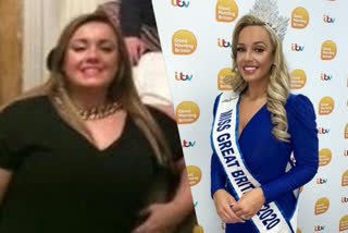 മിസ് ഗ്രേറ്റ് ബ്രിട്ടൻ  ജെന്‍ അറ്റ്കിന്‍  ബ്രിട്ടൻ സുന്ദരി പട്ടം  Jen Atkin becomes Miss Great Britan  jen  fat girl won miss grate britain