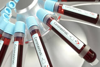 Coronavirus: 51 samples test negative in Guj; 2.2k screened