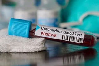 Dead man's sample found coronavirus positive