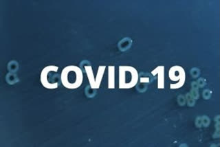 Can AI help in fighting against COVID-19 ?