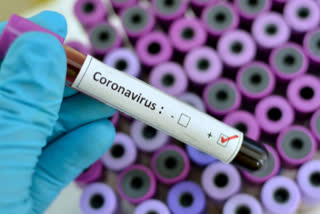 Six week old newborn dies of coronavirus in US says state governor