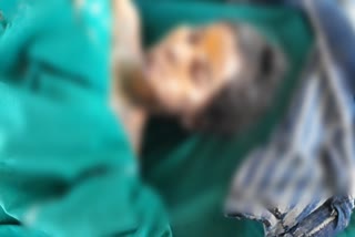 girl died in cylinder blast in yadgir
