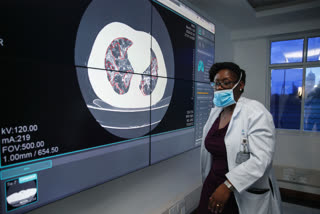 CT scan image of a lung in Kenyan hospital