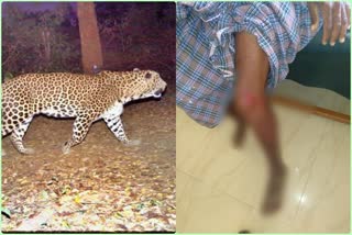 leopard-attack-an-man-in-chamrajnagar