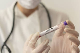 Dead man's sample tests positive for coronavirus in Akola  മരിച്ച 45 കാരന് കൊവിഡ് 19 സ്ഥിരീകരിച്ചു  കൊവിഡ് 19 സ്ഥിരീകരിച്ചു  മഹാരാഷ്ട്ര  അകോല