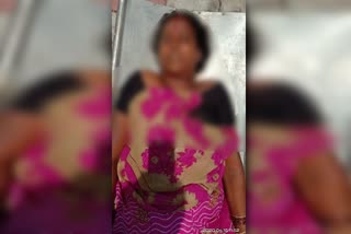 The woman committed suicide In Bellary