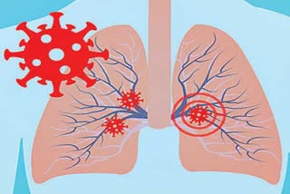 coronavirus can damage patient's lungs and kidney function in the long period