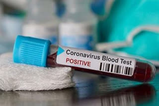 Migrant labourer creates coronavirus scare in Bengaluru