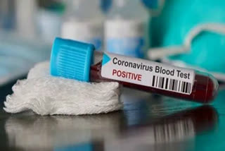 corona virus cases update in delhi