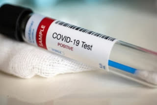 COVID-19  test laboratory