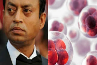 know all about endocrine tumor which killed irfan khan by famous oncologist dr.pk julka