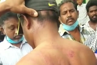 police men beat to valunteer for not wearing mask in doddipadu kurnool district