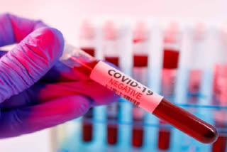 RPF constable attracts corona virus in delhi