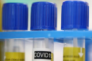 COVID-19 cases in Indore rise to 2,107